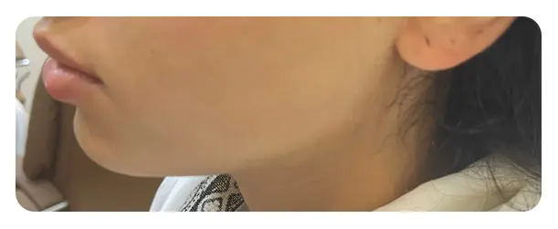 Before image