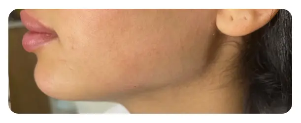 After image